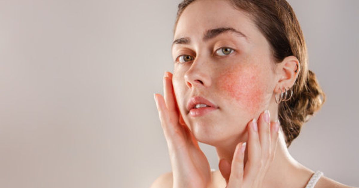 Early Symptoms of Skin Disorders