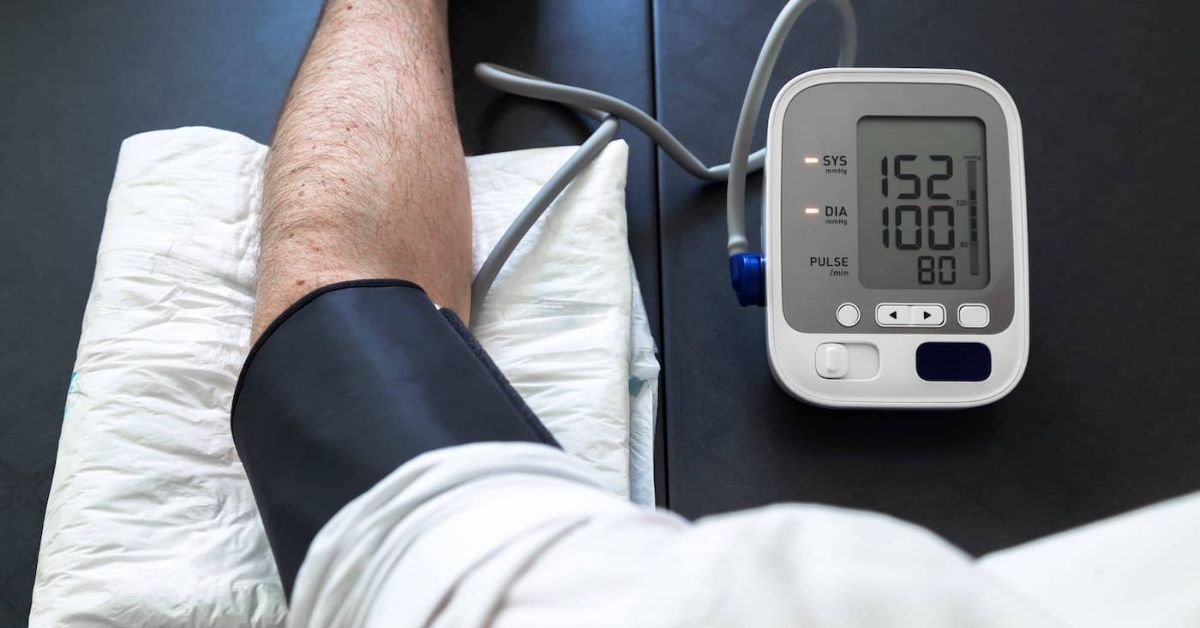 Hidden Signs of High Blood Pressure