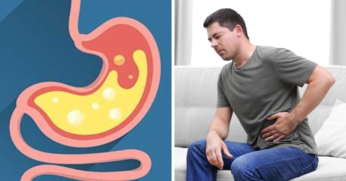 How to Remove Gas from Stomach Instantly