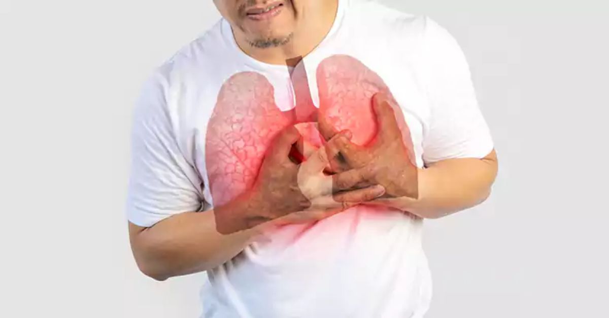 Symptoms of Lung Cancer in Men