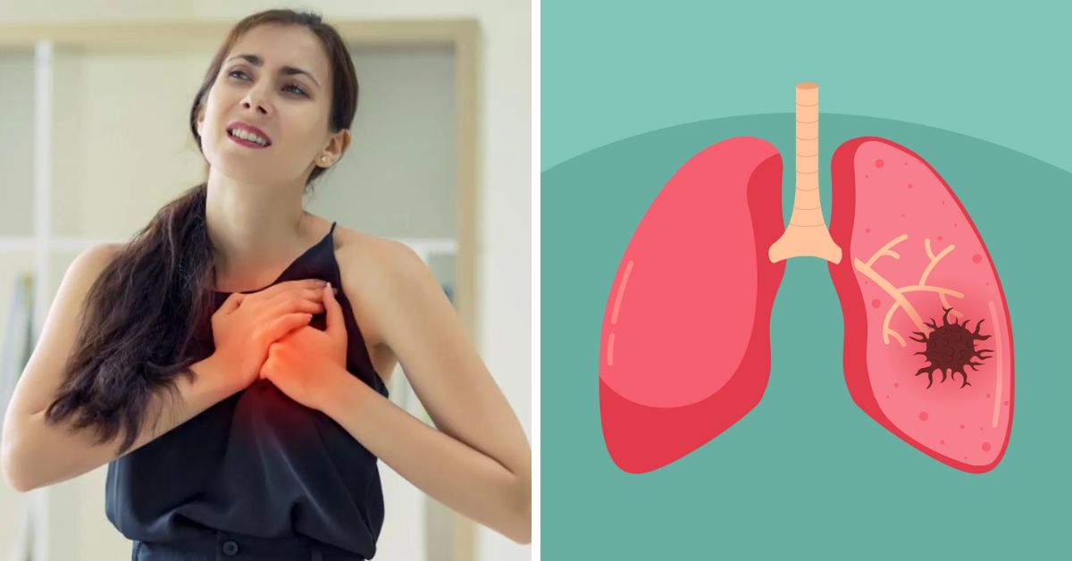 Symptoms of Lung Cancer in Women